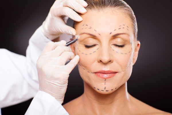 facial feminization surgery